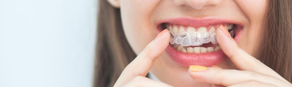 woman holding Invisalign with two index fingers