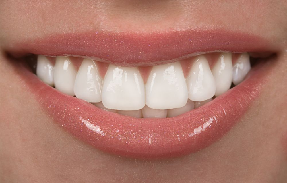 what to eat after teeth whitening