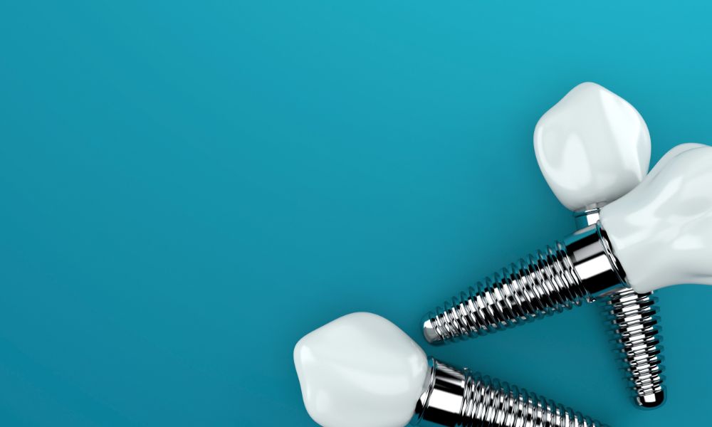 Misconceptions About Dental Implants