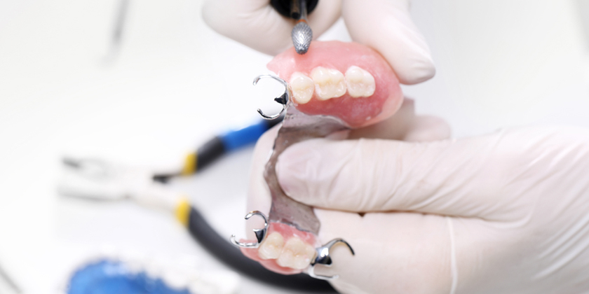 How Crowns Can Be Retrofitted To Partial Dentures