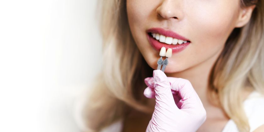 How Porcelain Veneers Can Improve The Appearance Of Your Teeth