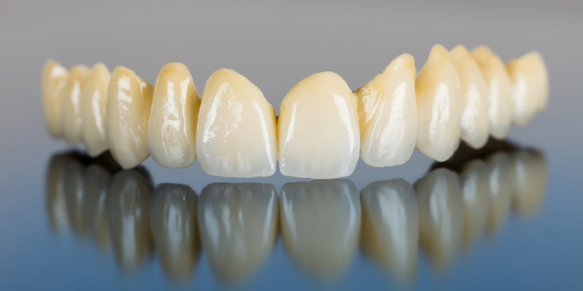 dental bridges replaceing missing teeth