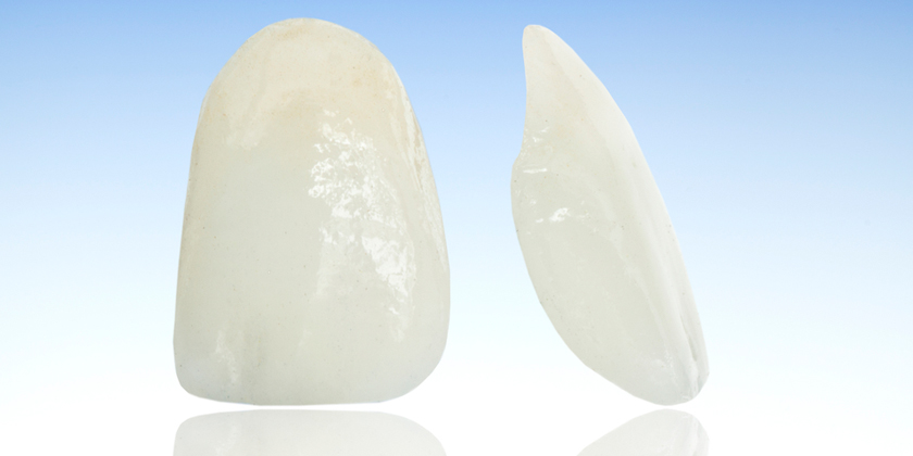 porcelain veneers tackle dental appearance problems