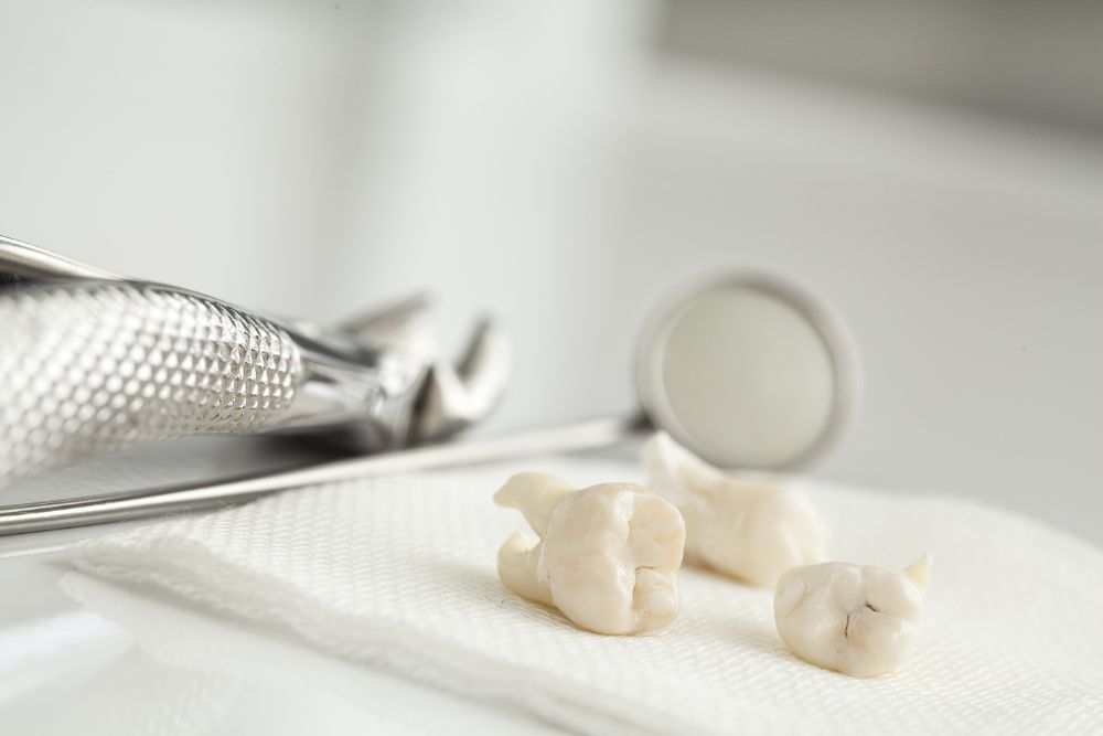 Dental Implant Maintenance