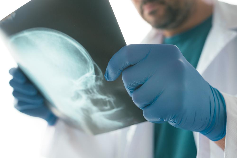 Leaving A Broken Jaw Untreated