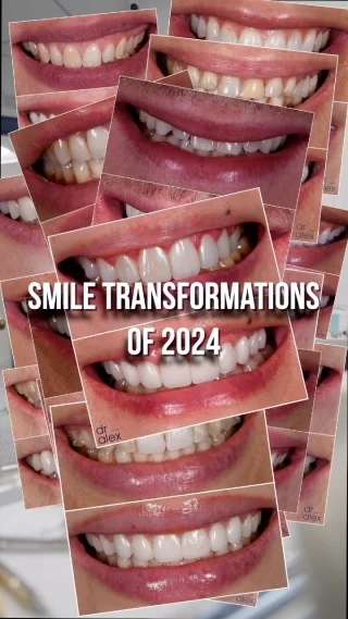 Reflecting on a year of hard work and meaningful results. Whether it’s crafting new smiles or maintaining healthy ones, every patient’s journey is a reminder of why I’m passionate about what I do.

As 2025 begins, I’m inspired to keep raising the bar and delivering care that truly makes a difference.

#NYCCosmeticDentist #smiletransformation #veneers #CosmeticDentistry #VeneersJourney #PorcelainVeneers #CosmeticDentistry #2025