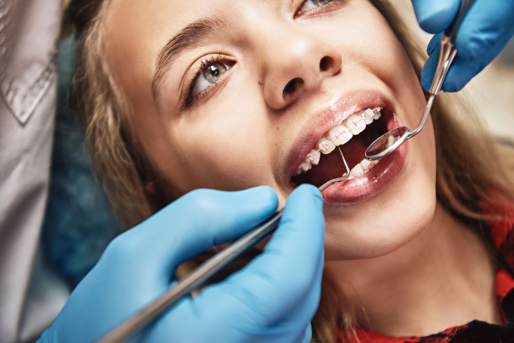10 Brace Problems You Can Avoid with Invisalign
