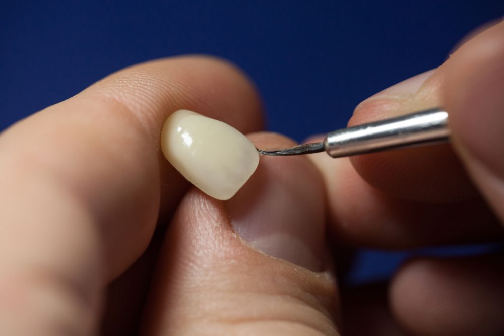 5 Steps To Maintain Your Porcelain Veneers To Keep Them Looking Brand New