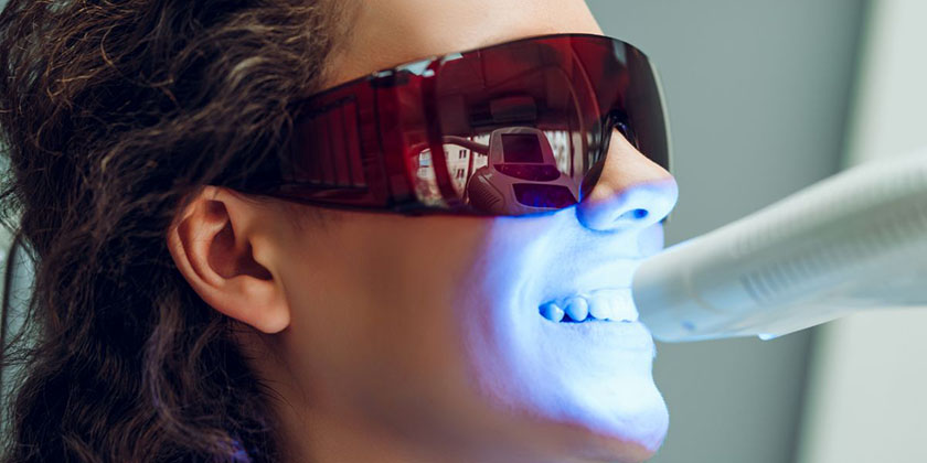 5 Things You Shouldn’t Do After Whitening Your Teeth
