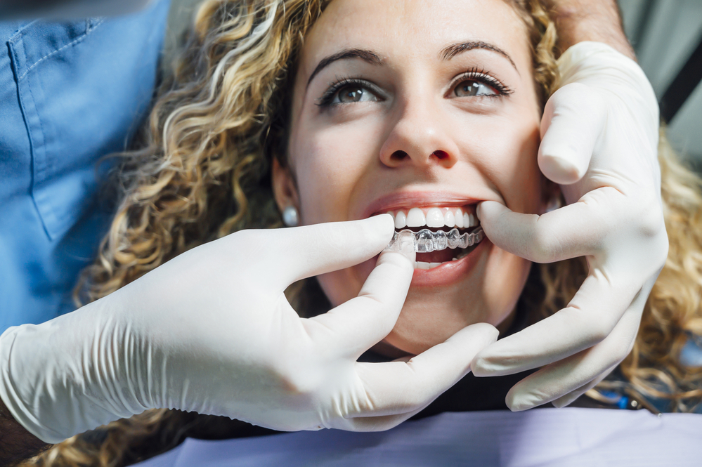 Invisalign treatment