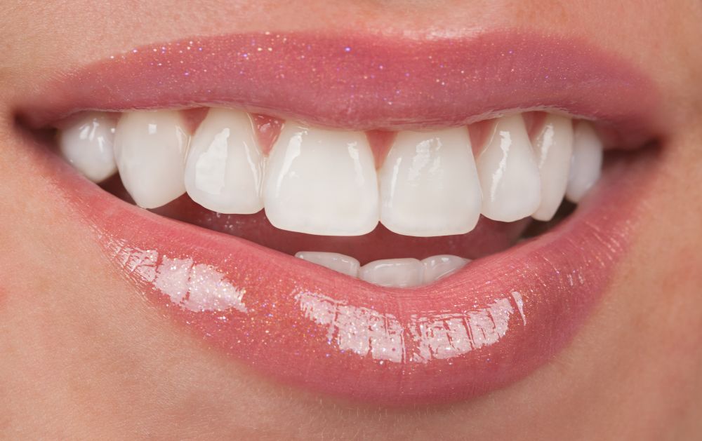 A Guide To The Recovery Timeline For Dental Smile Makeover