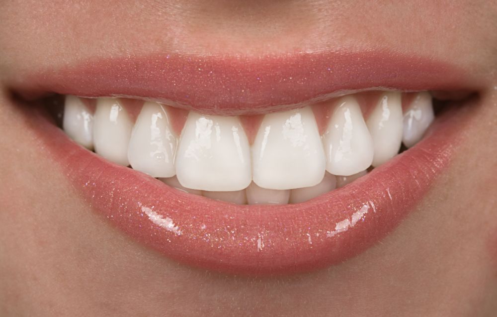 After Teeth Whitening Diet: What To Eat & Avoid For Long-Lasting White Teeth