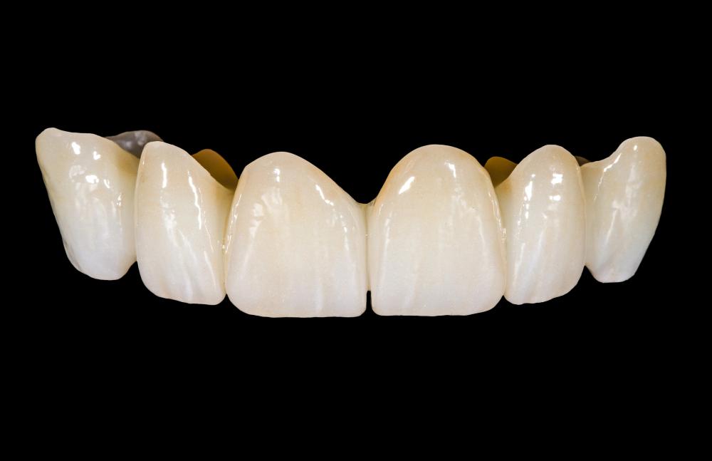 All You Need To Know About Zirconia Dental Implants