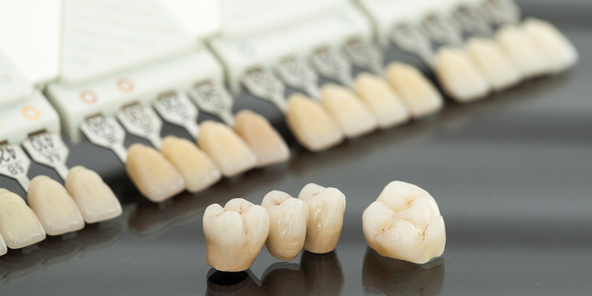 Are Porcelain Veneers Invulnerable To Stains?