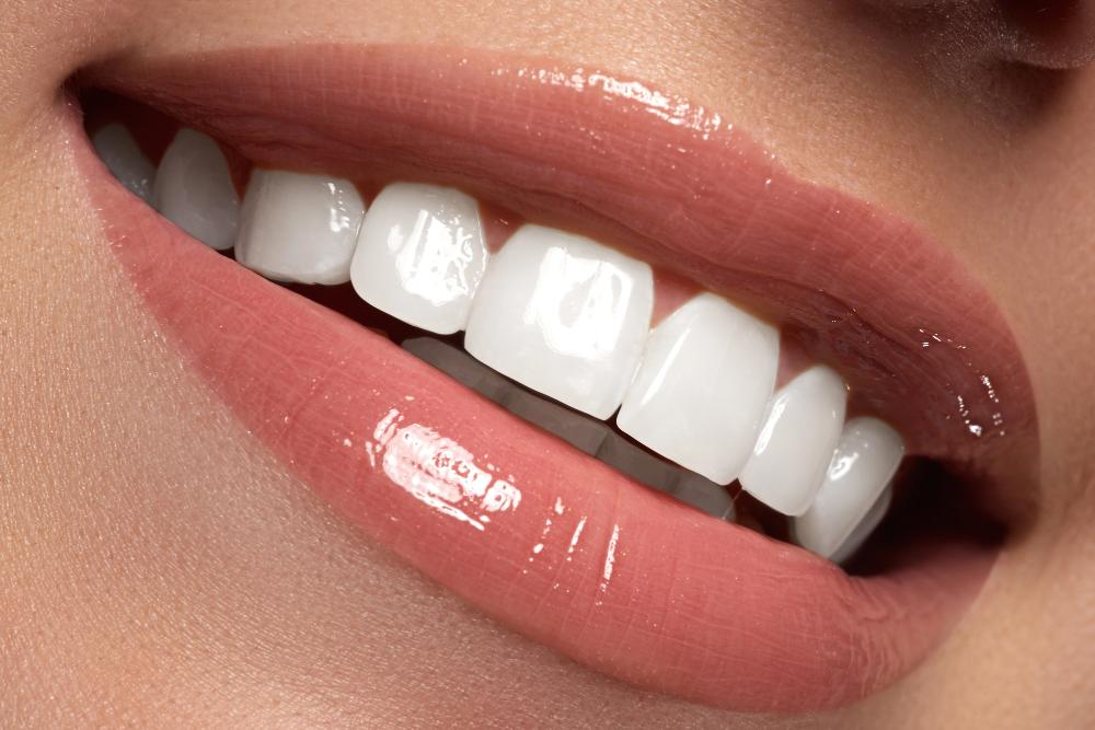 Are You Prepared For A Smile Makeover?