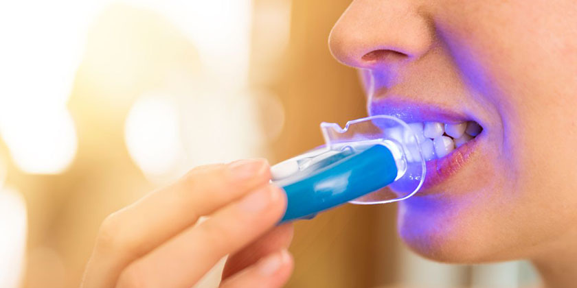 At Home Vs. Professional Teeth Whitening: Which Is More Effective?