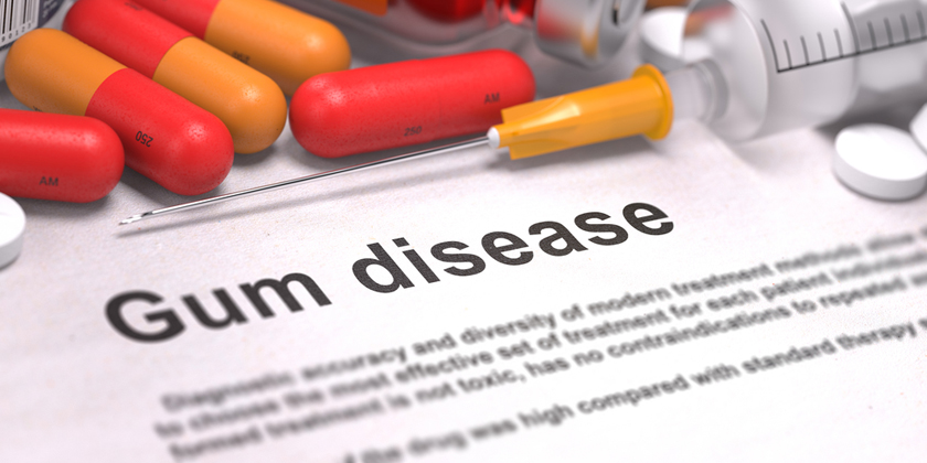 autoimmune and gum disease