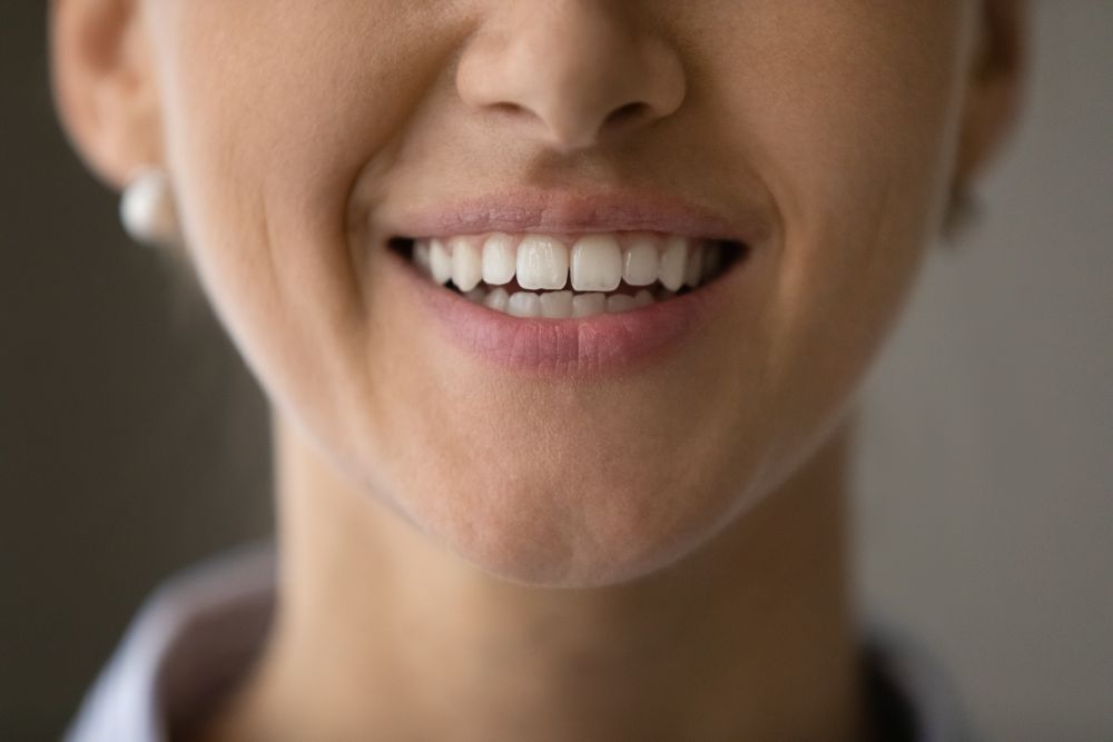 Can Veneers Straighten Teeth?