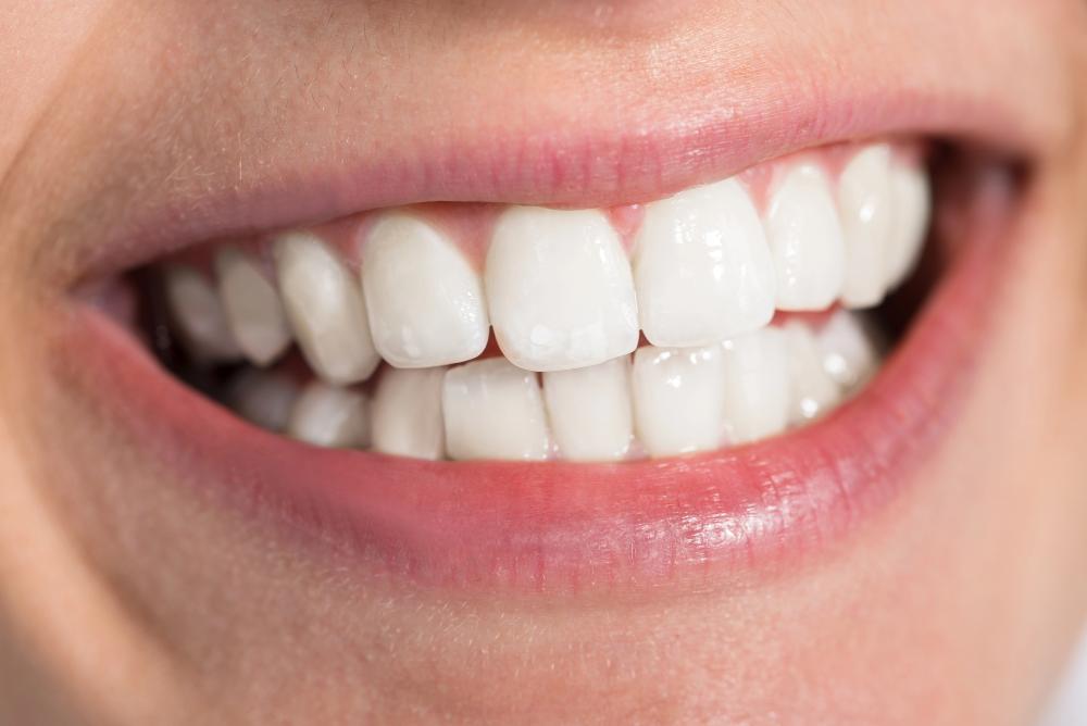 Can You Get Invisalign If You Have A Dental Crown?