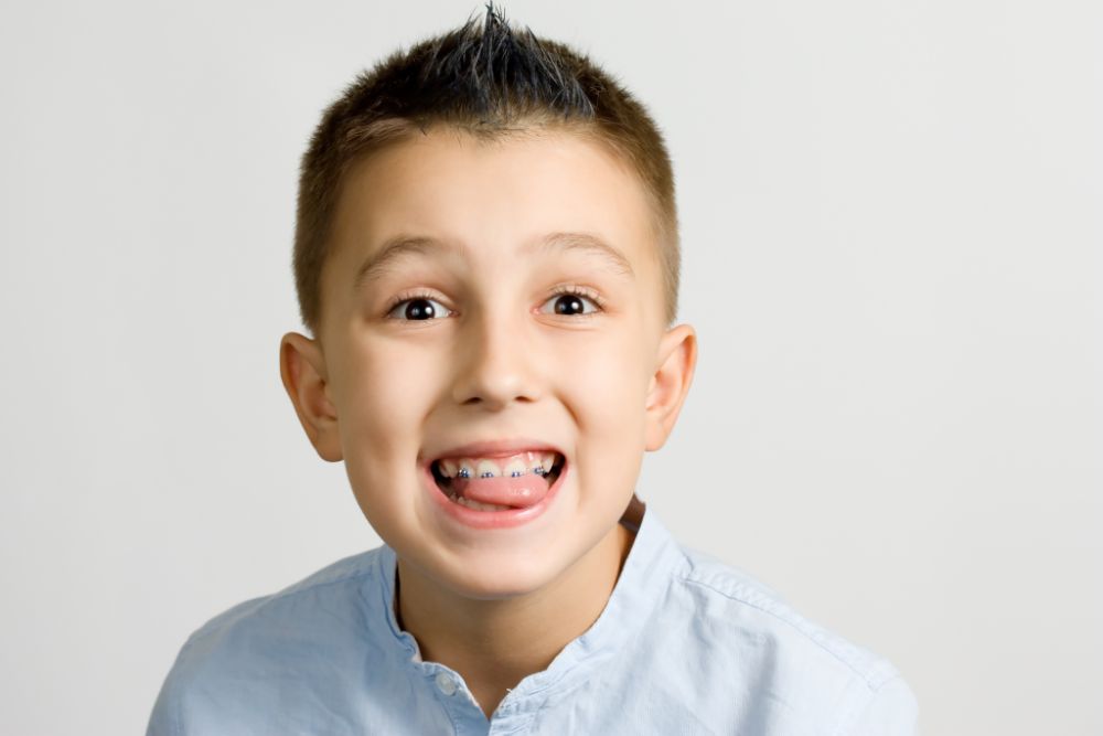 Dental Braces For Children