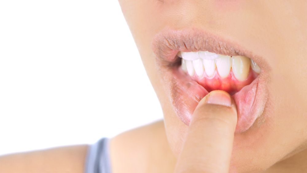 Managing Your Dental Health While On Cancer Treatment
