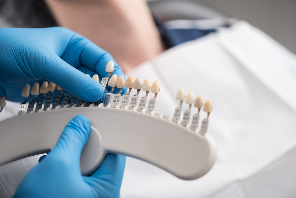 Dental Implants: How They Function Like Natural Teeth