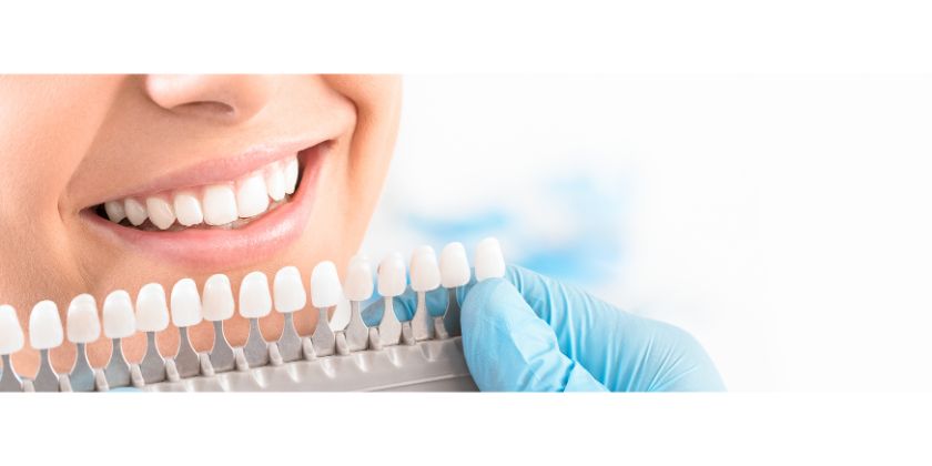 Dental Veneers Can Help Combat Dental Damage