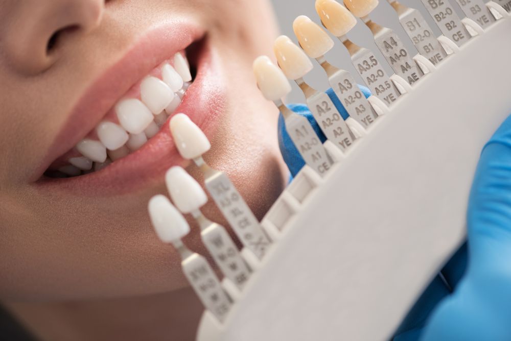 Do Dental Crowns Hurt? Overcoming Your Fears
