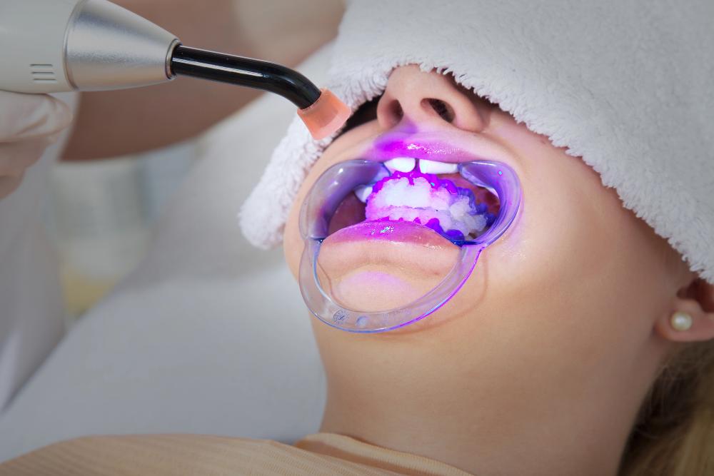 Does Teeth Whitening Really Get Rid Of Coffee Stains?