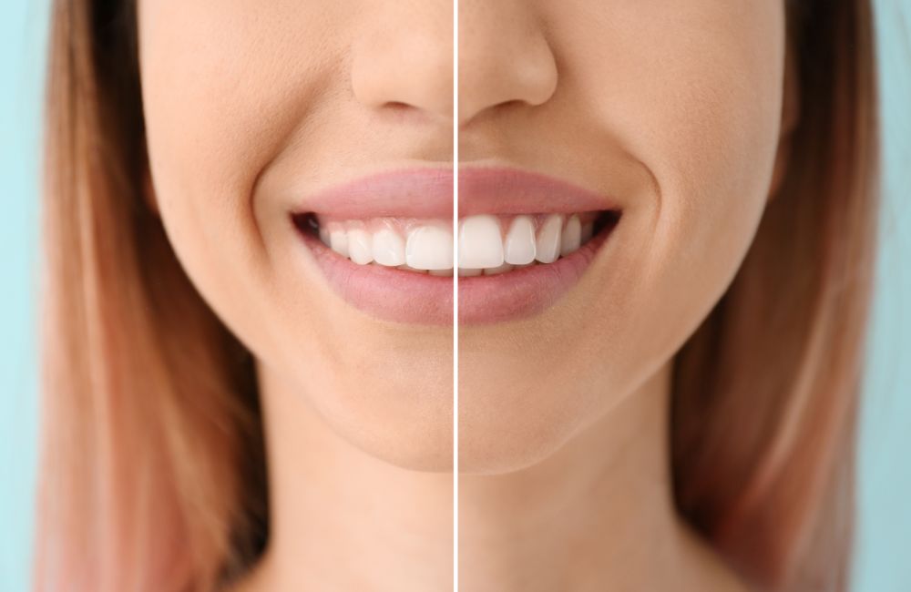 Cosmetic Dentistry