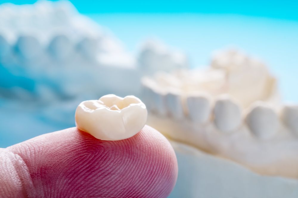 Four Bad Habits That Could Damage Your Dental Crowns