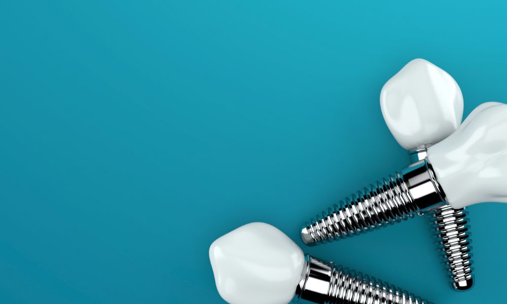 Four Common Misconceptions About Dental Implants