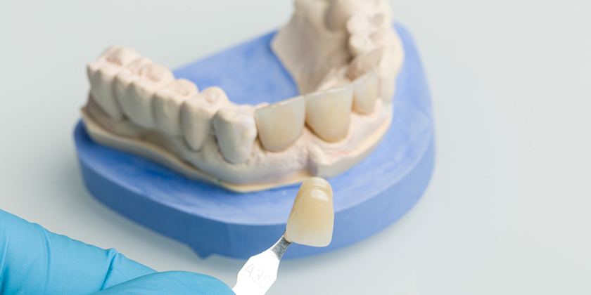 Getting The Right Porcelain Veneers For Your Face