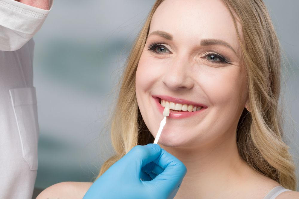 Veneer Maintenance
