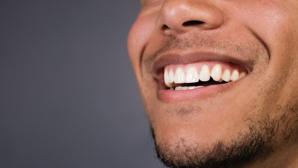 Gummy Smile Makeover Treatments: Which Option Right For You?