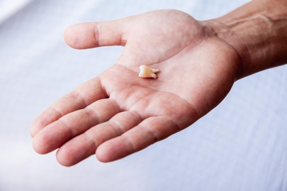 Here’s What To Do If A Permanent Tooth Falls Out