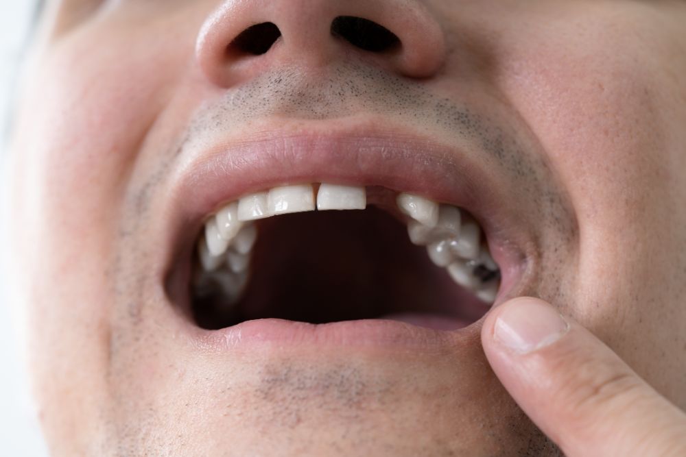 How Dental Issues Can Tell About Your Overall Health