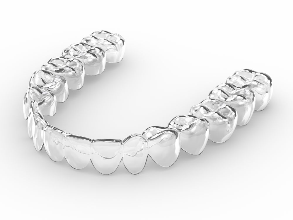 How Did Invisalign Come About?