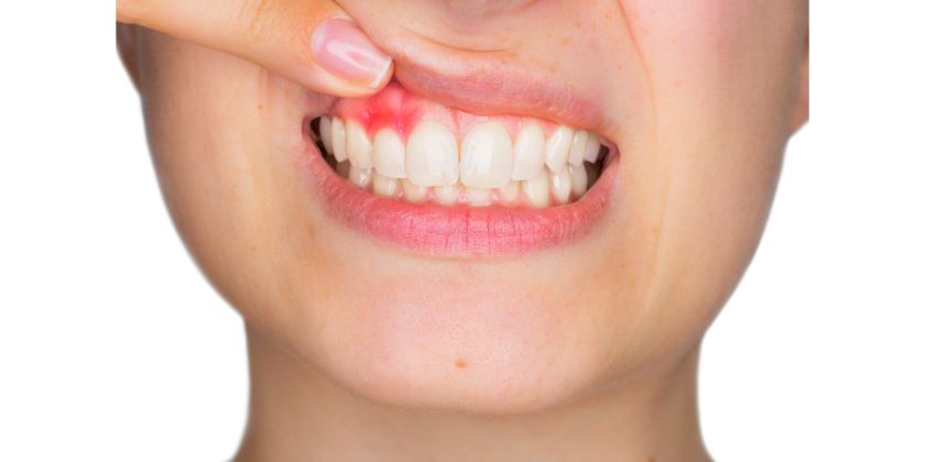 How Does Gum Disease Affect Your Lifestyle?