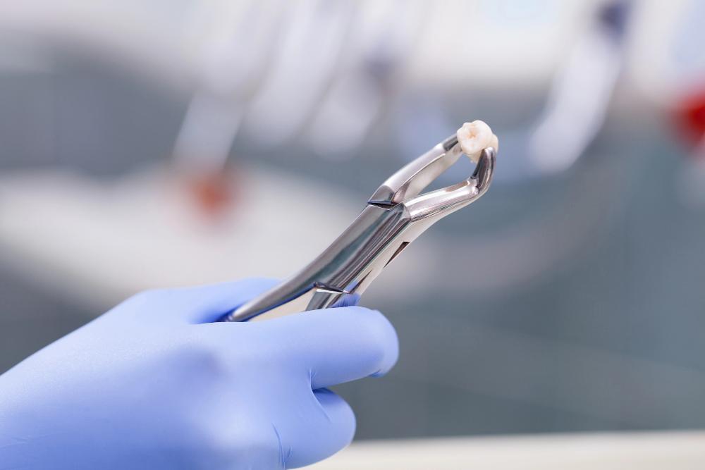 How Long After A Wisdom Tooth Extraction Can You Eat?
