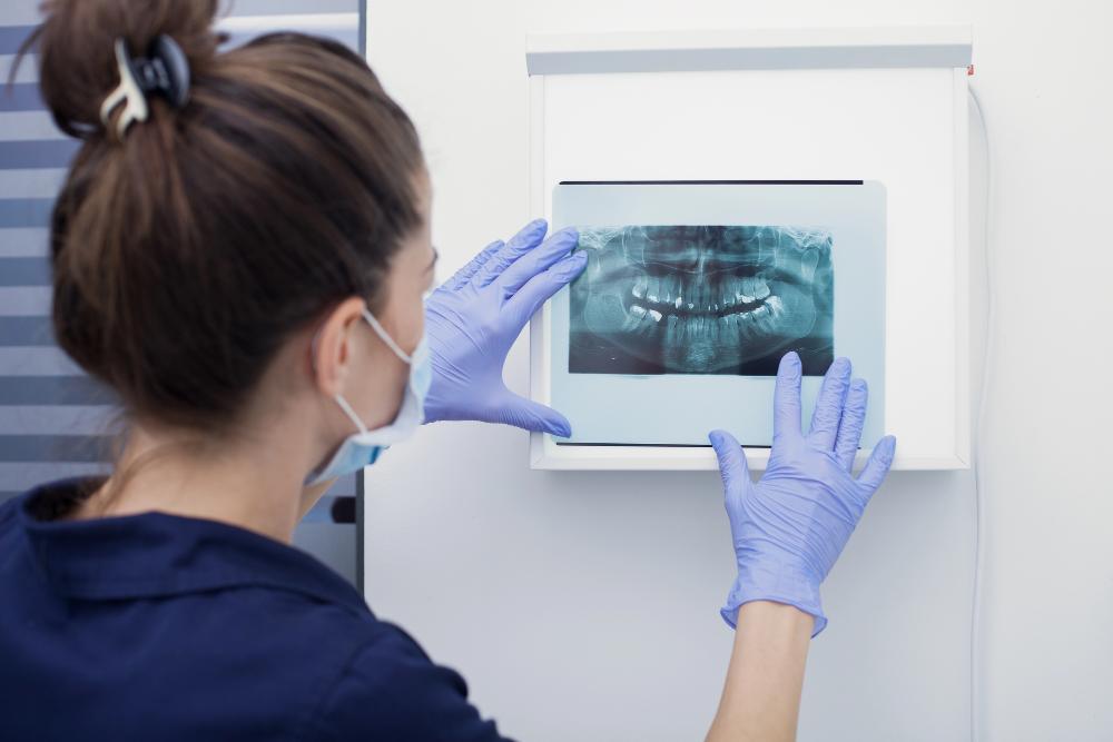 How Many Dental X-Rays Are Safe In A Month?