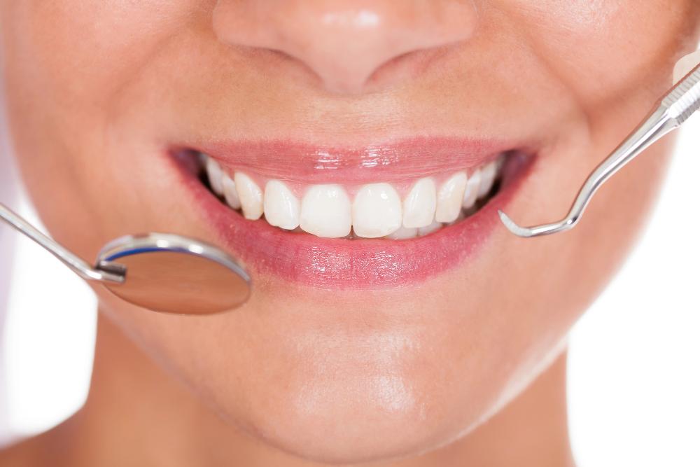 How Many Veneers Do You Really Need For A Perfect Smile?