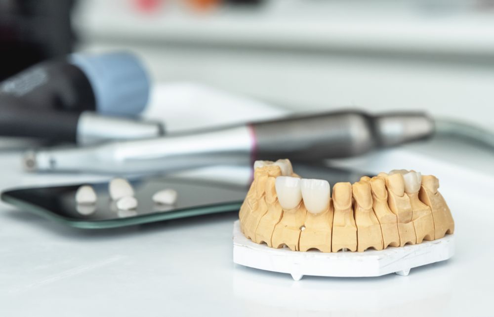 Do Veneers Cause Bad Breath?
