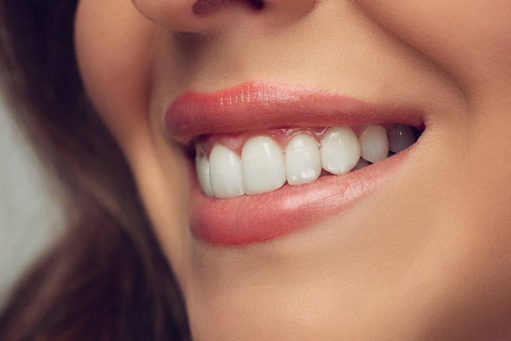 How To Treat Burned Gums From Teeth Whitening