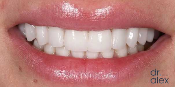 After Image