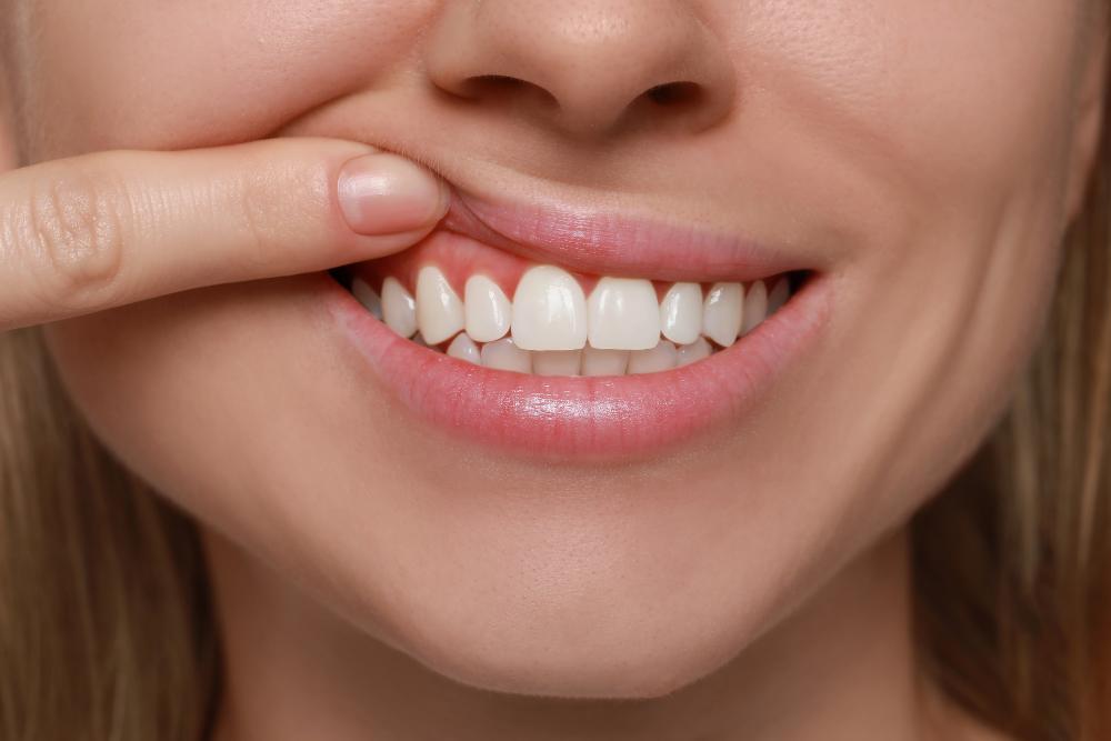 Is Gum Disease Curable?
