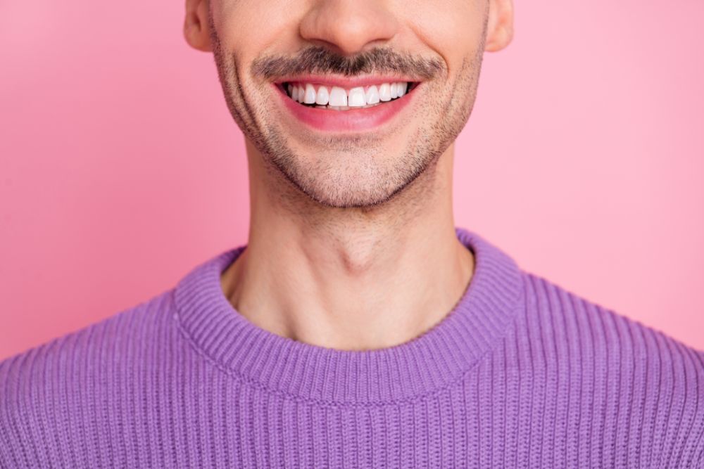 Is Shaved Teeth For Veneers Really Needed?