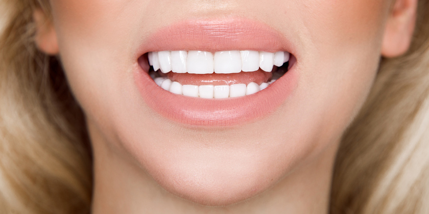 Living With Porcelain Veneers: Dos and Don’ts