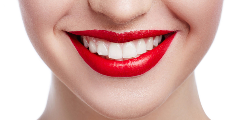 Look like A Celebrity with Porcelain Veneers in NYC!
