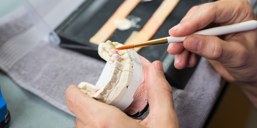 Porcelain Veneer Placement Expectations